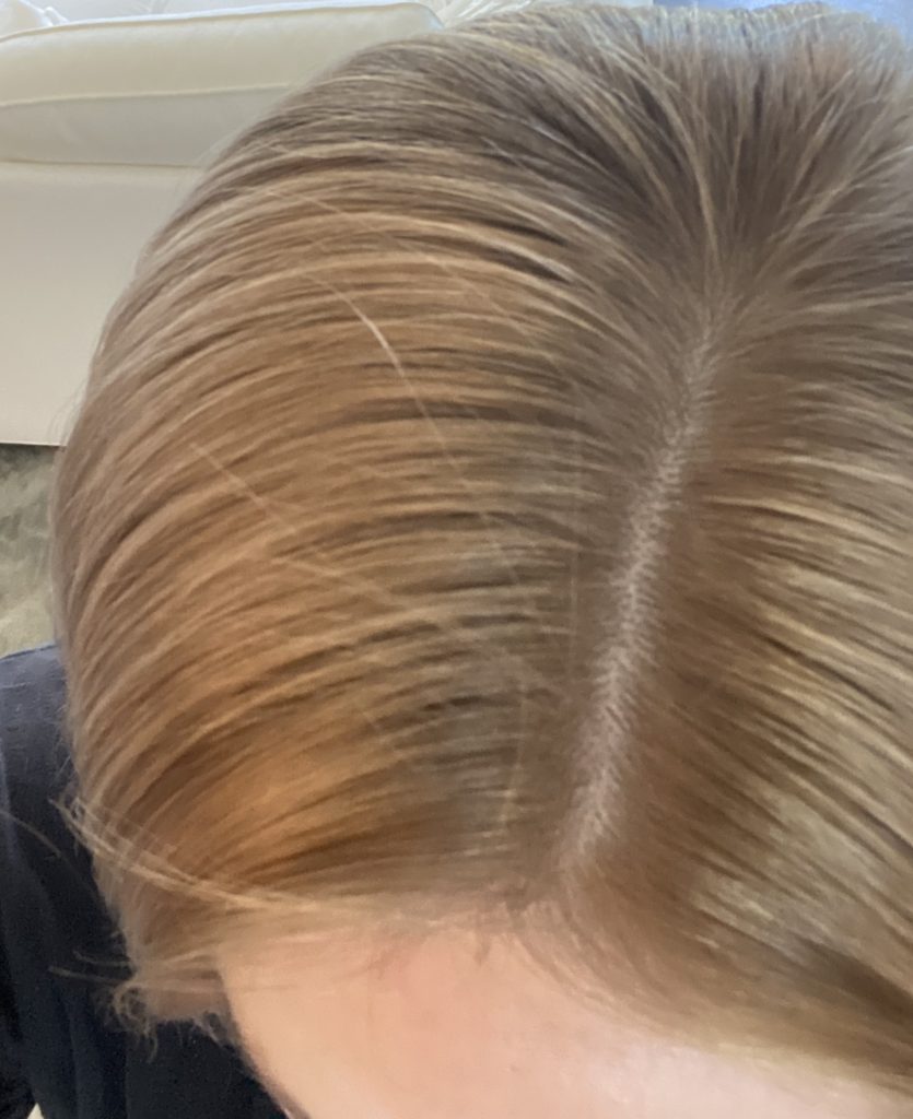 After Toner without bleaching (Color is Blended)