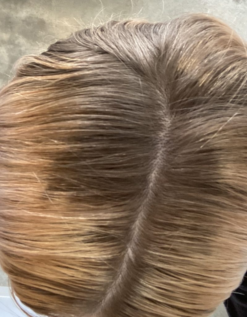 hair with bad roots showing before using toner