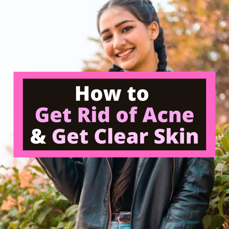 5 Easy Steps to Get Rid of Acne for Teenage Girls